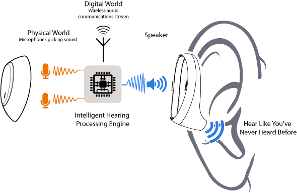 What is Intelligent Hearing?