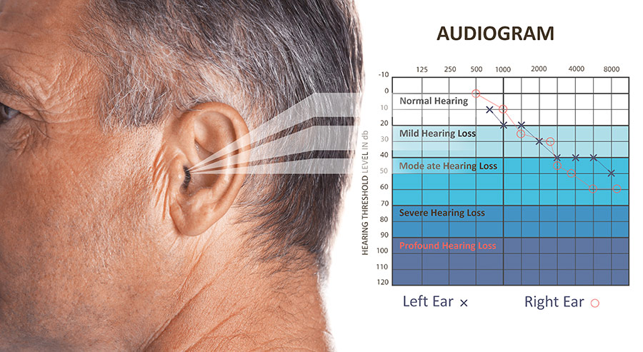 audiogram used to test human hearing frequency range