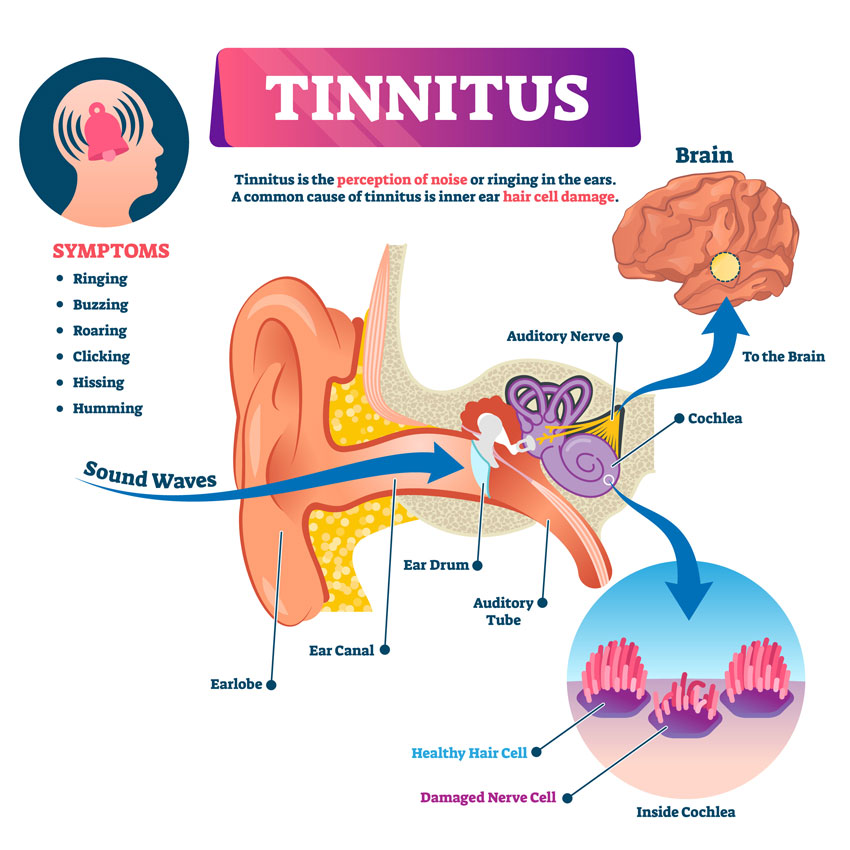 tinnitus-breakdown tinnitus symptoms and anatomy